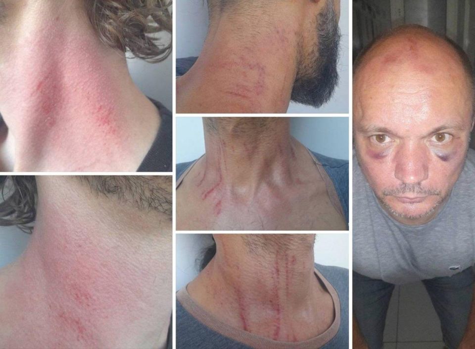 Черкасский ТЦК удерживает семь человек, которых избивают и заставляют подписывать документы